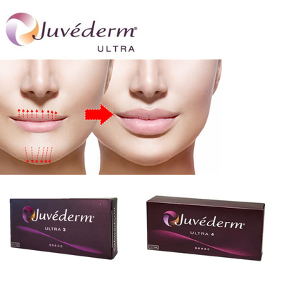 Juvederm Ultra3 Acido Ialuronico per le labbra Gel per iniezioni cutanee preriempito
