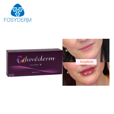 Iniezione acida ialuronica collegata incrocio cutaneo dei riempitori del labbro di Juvederm 2*1ml per antinvecchiamento