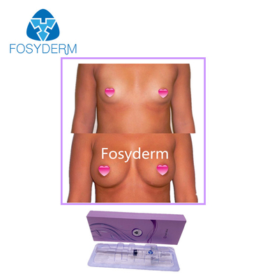 Riempitori cutanei natica dell'acido ialuronico di Fosyderm 10ml ed iniezione dell'ingrandimento del seno