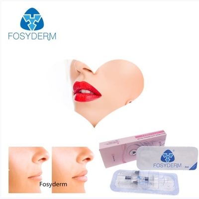 Gelifichi Fosyderm 2ml attraversano il riempitore cutaneo collegato dell'acido ialuronico per il potenziamento del labbro