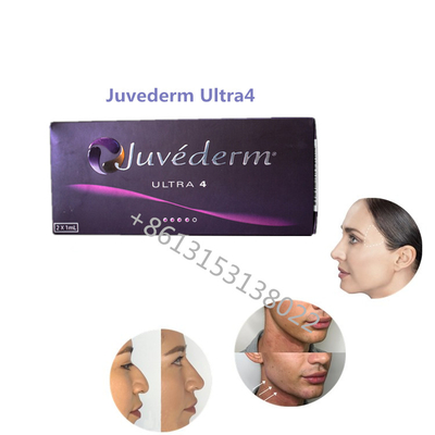 Riempitori cutanei di Juvederm ha del riempitore di Juvederm Ultra4 Allergan di pienezza del labbro per le labbra