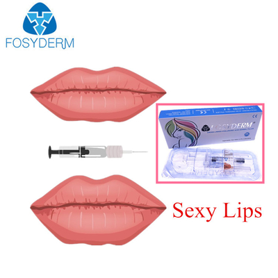 Riempitore cutaneo acido ialuronico di Fosyderm per pienezza delle labbra una linea profonda da 2 ml