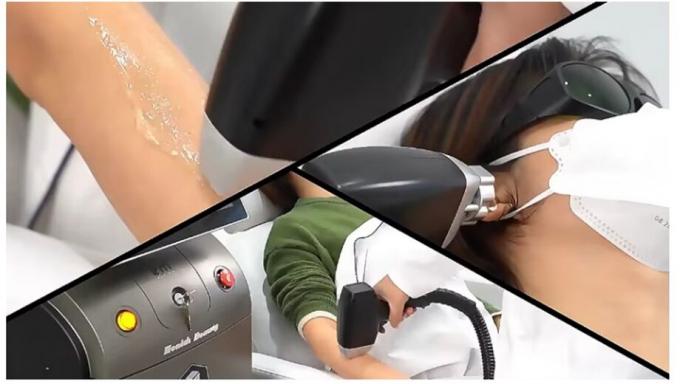 Potente nuovo diodo di ghiaccio da 808 nm Trio 3 onde diodo laser 810 nm depilazione 808 nm depilazione 3 onde Titanio Medical Machi 2