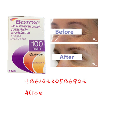 L'anti tossina botulinica antinvecchiamento Allergan della grinza scrive una polvere a macchina di Botox