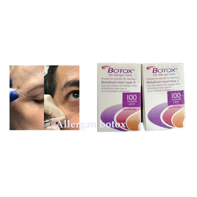 L'iniezione di Allergan  della tossina botulinica per la grinza rimuove