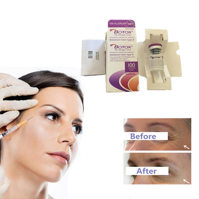 Grinze coreane di rimozione del  del  100iu Allergan delle tossine botuliniche