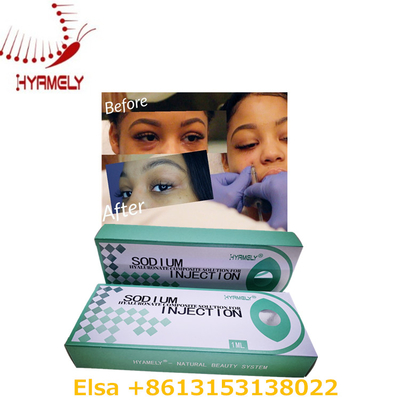1 ml di gel ialuronato di sodio anti occhiaie filler dermico per gli occhi