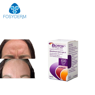 Antirughe  De Allergan 100 unità di iniezione
