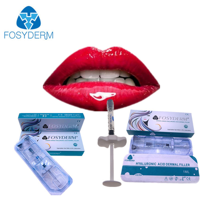 Iniezione più grassoccia Fosyderm 1ml Derm del riempitore dell'ha delle labbra