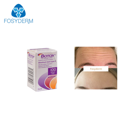 100Units Allergan Toxion botulinico per rimuovono il tipo facciale A di  delle grinze