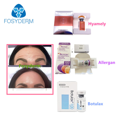 Un tipo di 100 unità iniezione facciale di  Botulax delle grinze di Allergan della tossina botulinica un'anti