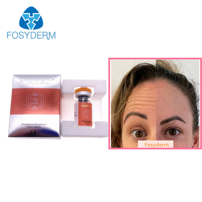 Un tipo di 100 unità iniezione facciale di  Botulax delle grinze di Allergan della tossina botulinica un'anti