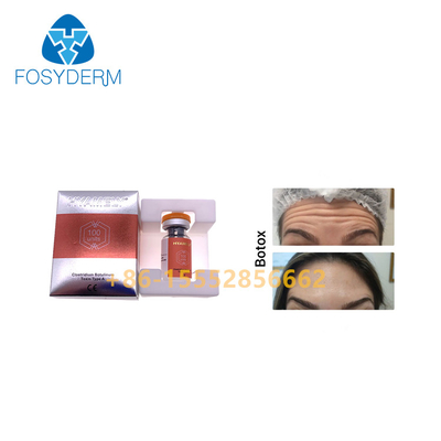 grinze  Allergan dell'iniezione della tossina botulinica di 100units TypeA anti