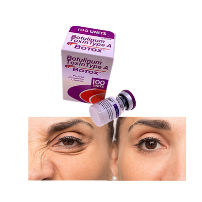 Rimuovendo le linee facciali unità Allergan Botoxo della tossina botulinica 100