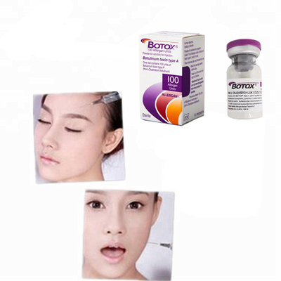 Tossina botulinica 100iu 200iu Allergan  in polvere per iniezione Botulax