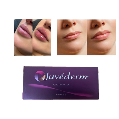 Juvederm Acido Ialuronico Riempitore Dermico Antirughe Riempitore Faciale per labbra