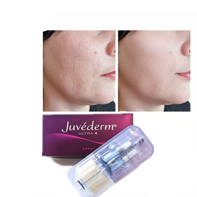 Juvederm Acido Ialuronico Anti-Invecchiamento 2*1ml