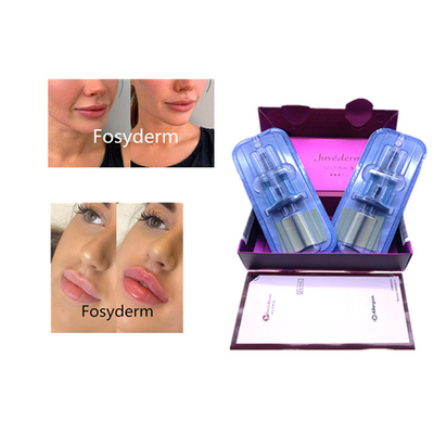 Juvederm Acido Ialuronico Anti-Invecchiamento 2*1ml