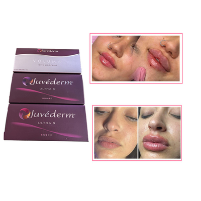 Iniezioni per la cura della pelle Plumper per labbra Juvederm Acido ialuronico Riempitore cutaneo per il viso