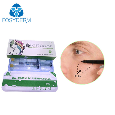 Fosyderm Deep 2ml Dermal Filler per il ringiovanimento facciale HA Filler