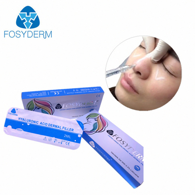 Juvederm Sicuri e naturali caricatori cutanei di acido ialuronico per la pienezza dei labbra facciale