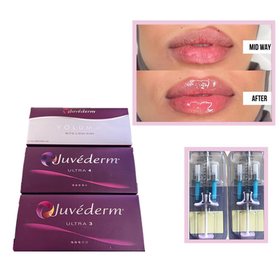 Juvederm Voluma Ultra3 Ultra4 HA Gel Riempitivi 2 ml Acido Ialuronico