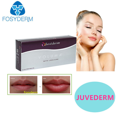 Juvederm Acido Ialuronico Riempitore Dermico Le labbra sexy 24 mg Per Riempitore Faciale