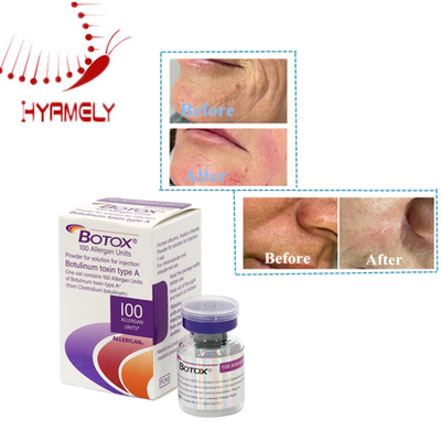Tossina Botulinica per la Cura della Pelle 100 Unità in Polvere Allergan Iniettabile