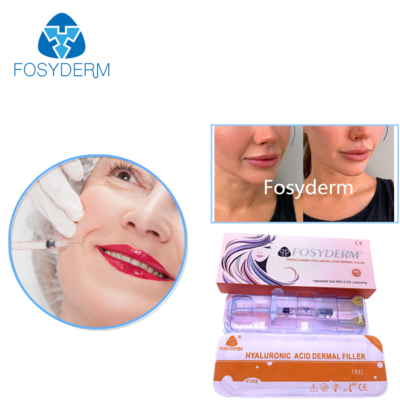 Filler dermico all'acido ialuronico 24mg/ml per viso, labbra, guance, mento