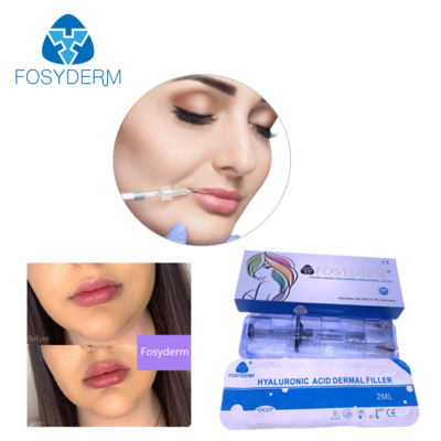 Filler dermico all'acido ialuronico 24mg/ml per viso, labbra, guance, mento