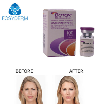 Iniezione di Botox Allergan 100 Unità per la Rimozione delle Rughe