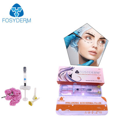 2 ml di filler per labbra per iniezione Acido ialuronico filler cutaneo iniettabile per gel di ingrandimento delle labbra