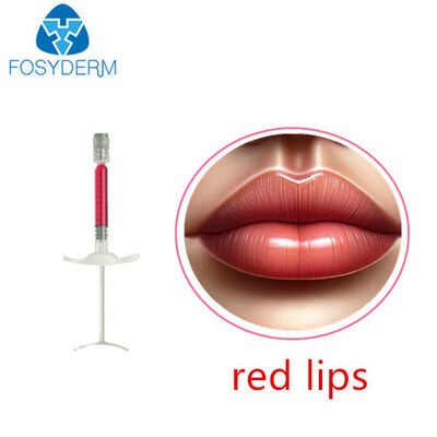Volume delle labbra con vitamina B12 1 ml 24 mg/ml Filler dermico Acido ialuronico Filler labbra rosse