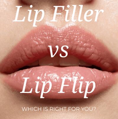 Volume delle labbra con vitamina B12 1 ml 24 mg/ml Filler dermico Acido ialuronico Filler labbra rosse