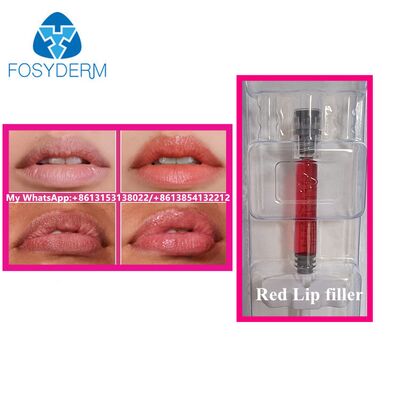 Filler labbra rosse con iniezione di vitamina B12 Filler acido ialuronico Bellezza Ingrandimento labbra 1 ml