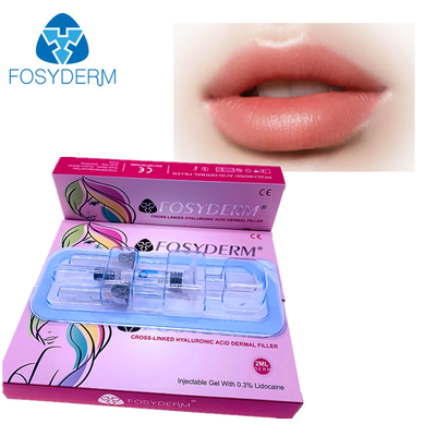 Filler dermico iniettabile a base di acido ialuronico ad alta viscosità per correzione del volume di zigomi, mento, naso e labbra