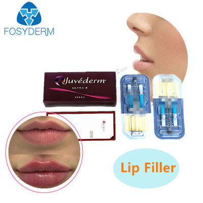 Riempitivo dermico all'acido ialuronico Juvederm per sollevamento labbra e viso 24mg
