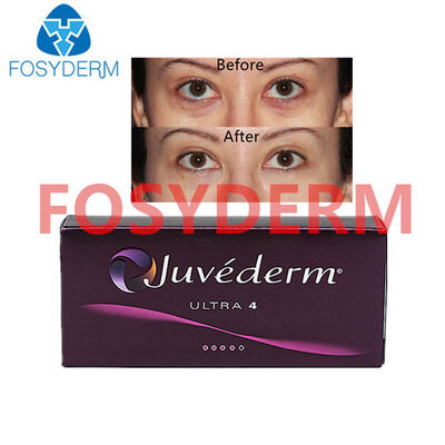 Riempitivo dermico all'acido ialuronico Juvederm per sollevamento labbra e viso 24mg