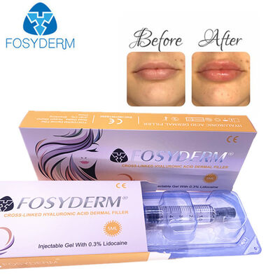 Acido Ialuronico Filler Dermico Antirughe Lifting Viso 1ml 2ml