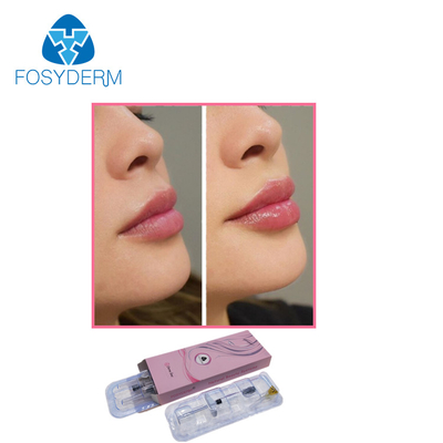 Riempitore cutaneo dell'iniezione dell'acido ialuronico di estetica 1ml di Fosyderm per il potenziamento delle labbra