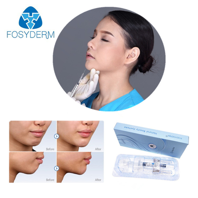 Iniezione acida ialuronica del gel del riempitore del labbro di Fosyderm Hyafilia 2ml