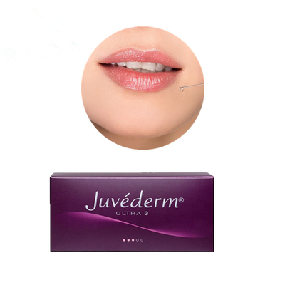 Acido ialuronico cutaneo della chirurgia plastica di Juvederm per il riempitore del labbro