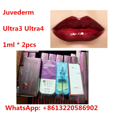 Riempitore cutaneo dell'ha del labbro di Juvederm con lidocaina Ultra3 Ultra4
