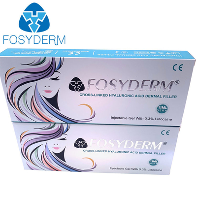 Riempitori acidi ialuronici di riempimento 1ml del labbro di Fosyderm Fosyderm dell'iniezione del fronte