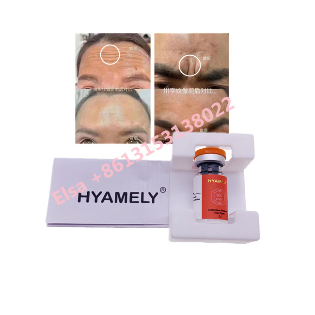 Tipo della tossina botulinica di Hyamely  un cosmetico coreano di  100u