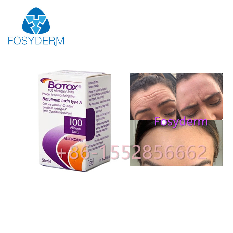 Allergan  100 grinze della tossina botulinica delle unità anti scrive un'iniezione a macchina