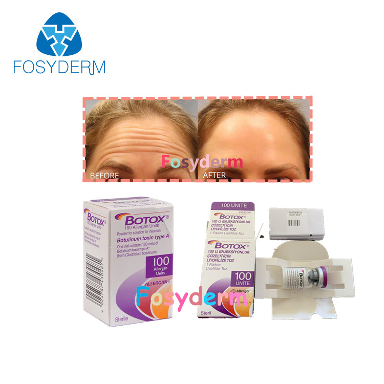 anti iniezione botulinica TypeA  di Allergan della tossina della grinza 100Units