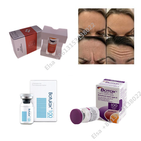 Allergan Botox Polvere per iniezioni di tossina botulinica Prodotto estetico Antimaturo