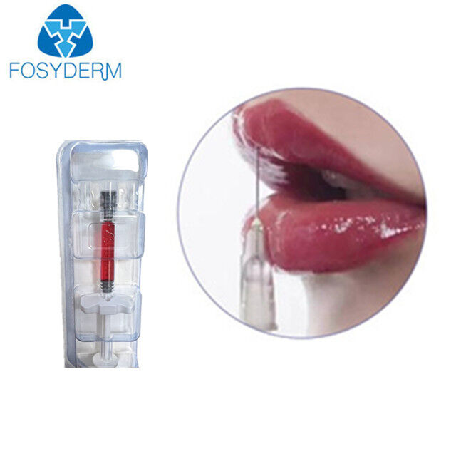 Volume delle labbra con vitamina B12 1 ml 24 mg/ml Filler dermico Acido ialuronico Filler labbra rosse