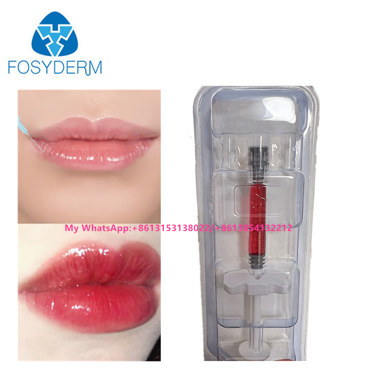 Riempitore per labbra rosso Acido ialuronico Iniezione di riempitore cutaneo con vitamina B12 per labbra 1 ml